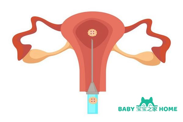 高龄女性延缓卵巢早衰的方法