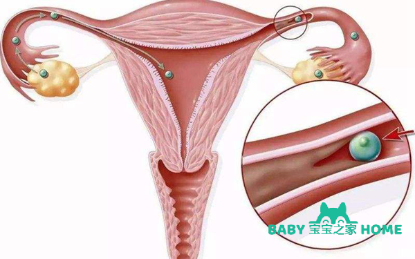 宫腔粘连的治疗方法